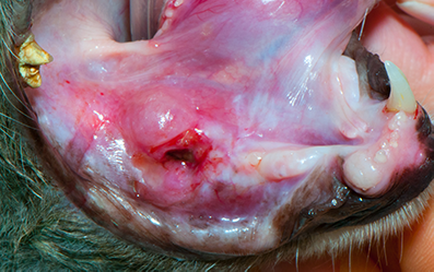 Oral Tumors - Squamous Cell Carcinoma